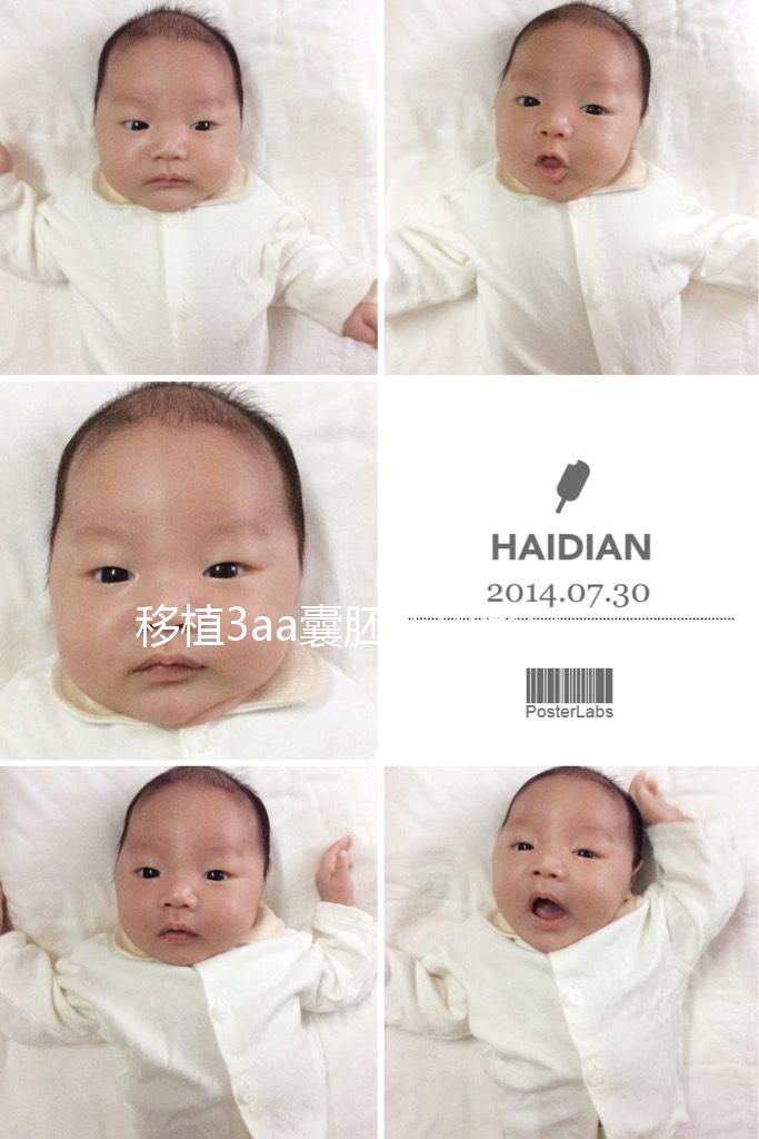 移植3aa囊胚成功率高嗎？詳解質量等級助孕更放心