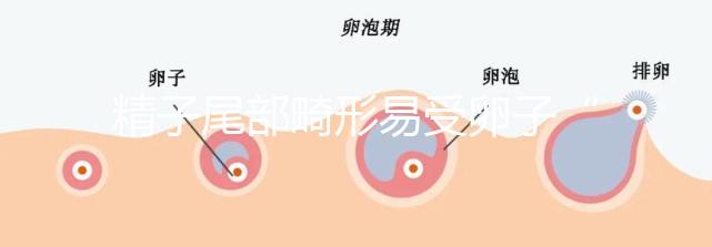 精子尾部畸形易受卵子“嫌棄”，無尾、短卷尾需重視