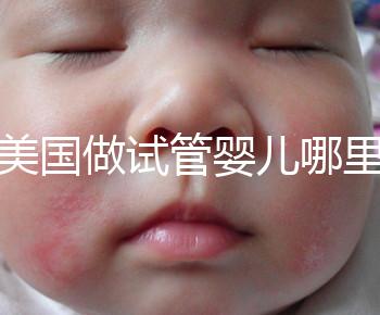 去美國做試管嬰兒哪里最好，4家好評輔助生殖機構推薦