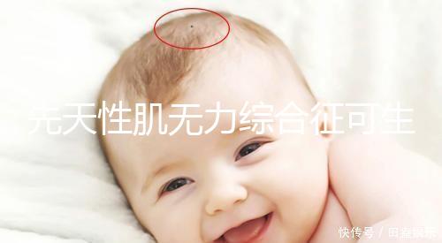 先天性肌無力綜合征可生育嗎？能做試管避免遺傳？