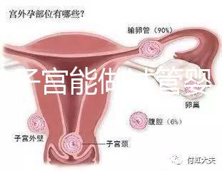 雙角子宮能做試管嬰兒嗎？可以，但這2大條件缺一不可
