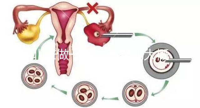 北京做一次試管嬰兒大概花多少錢？2025年價格及明細清單一覽！