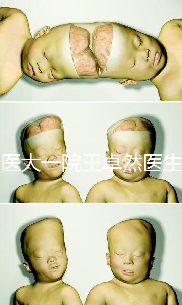 哈醫大一院王卓然醫生試管攻略,坐診時間、成功率早知道