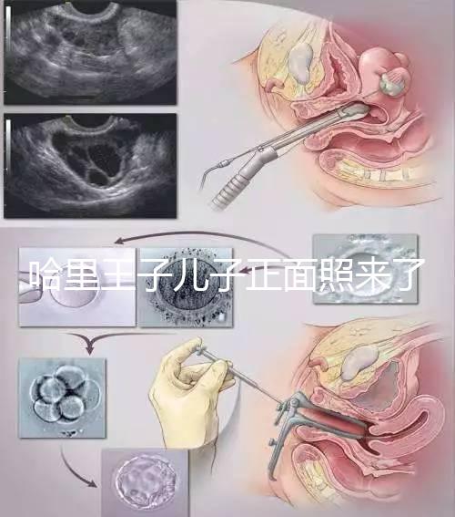 哈里王子兒子正面照來了,梅根評價:氣質甜美,乖巧