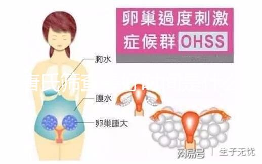 唐氏篩查最好時(shí)間是什么時(shí)候，內(nèi)蒙古單項(xiàng)費(fèi)用不超三百