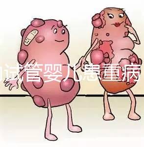 國內試管嬰兒患重病 試管是否存在健康隱患？