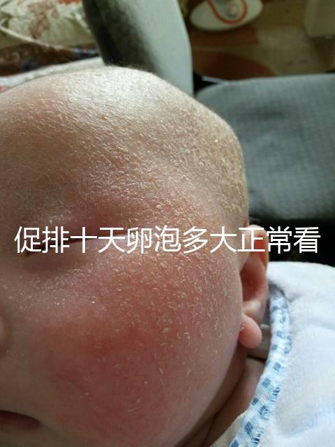 促排十天卵泡多大正常看這，1.1×0.9符不符合一文說清