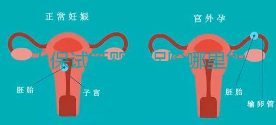 人保試管嬰兒保險(xiǎn)哪里能買、怎么買速覽，一篇看懂不踩坑