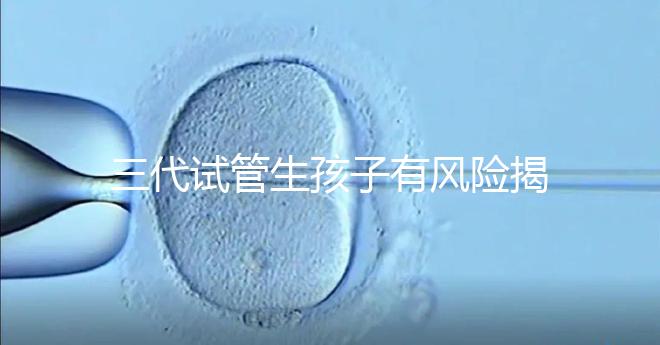 三代試管生孩子有風險揭秘嗎？嬰兒會有問題嗎？