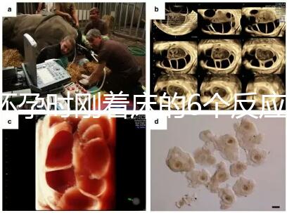 懷孕時剛著床的6個反應(yīng)，同房后這個時候觀察身體最準(zhǔn)