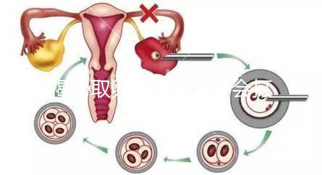 揭秘取卵后醫生會不會打電話問選幾代？這些問題會涉及到