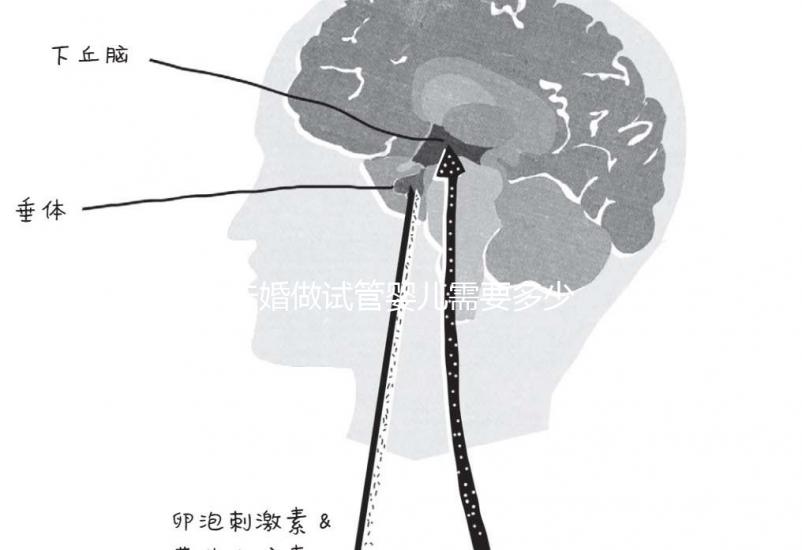 未婚做試管嬰兒需要多少錢？公立醫院費用大概在3-12萬