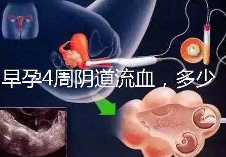 早孕4周陰道流血，多少天檢查血hcg或B超更穩(wěn)妥？