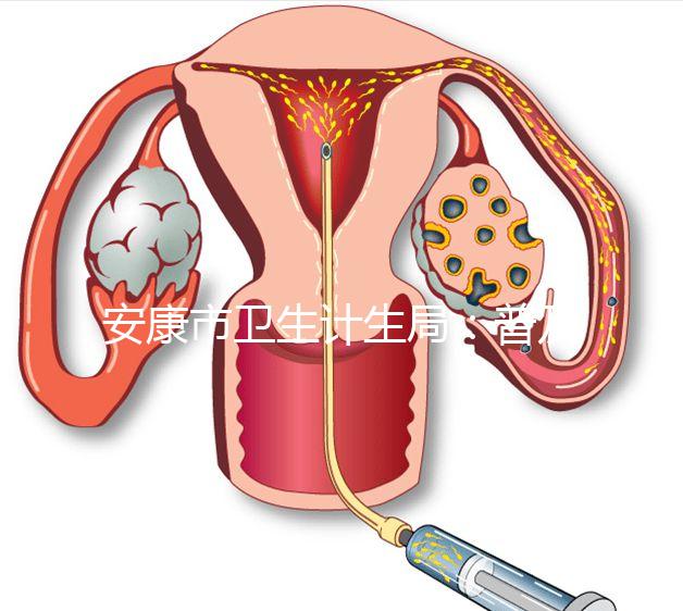 安康市衛(wèi)生計(jì)生局：普及優(yōu)生優(yōu)育五項(xiàng)檢查相關(guān)知識