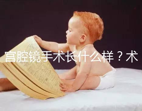 宮腔鏡手術長什么樣？術后要注意什么？ ?