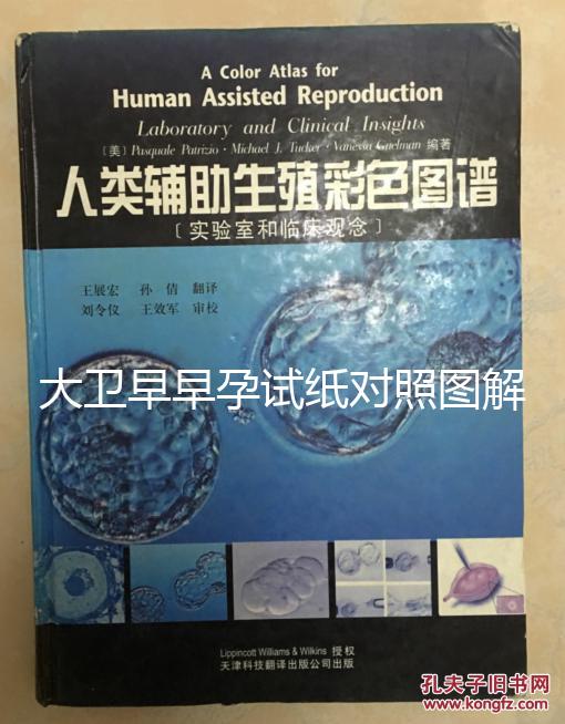 大衛早早孕試紙對照圖解，教你怎么看結果是不是陽性