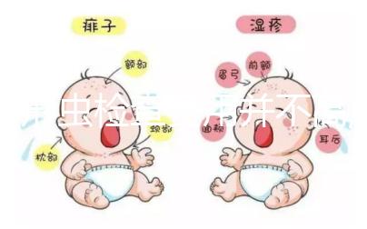 弓形蟲(chóng)檢查費(fèi)用并不高,為了寶寶健康建議孕前都做!