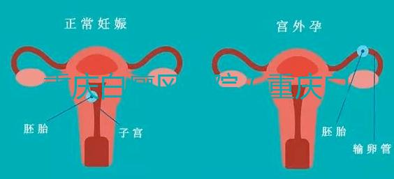 重慶白癜風醫院（重慶白癜風專科醫院在哪里）