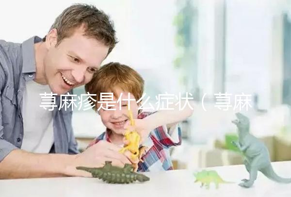 蕁麻疹是什么癥狀（蕁麻疹是什么癥狀和表現）