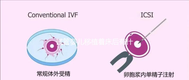 試管嬰兒移植著床后有什么反應（試管嬰兒移植著床后有什么反應嗎）