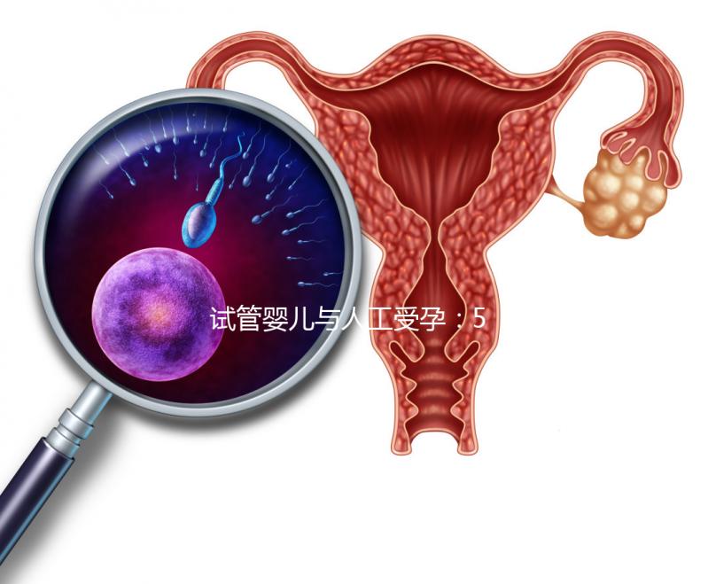 試管嬰兒與人工受孕：5個(gè)關(guān)鍵區(qū)別