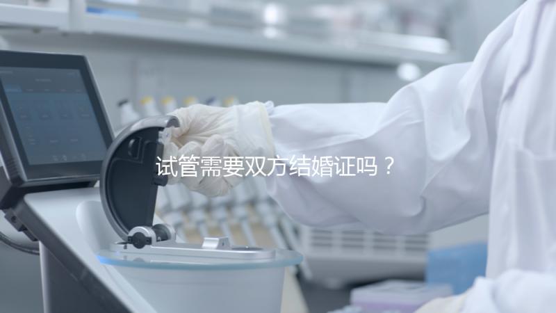 試管需要雙方結婚證嗎？試管是不是需要結婚證