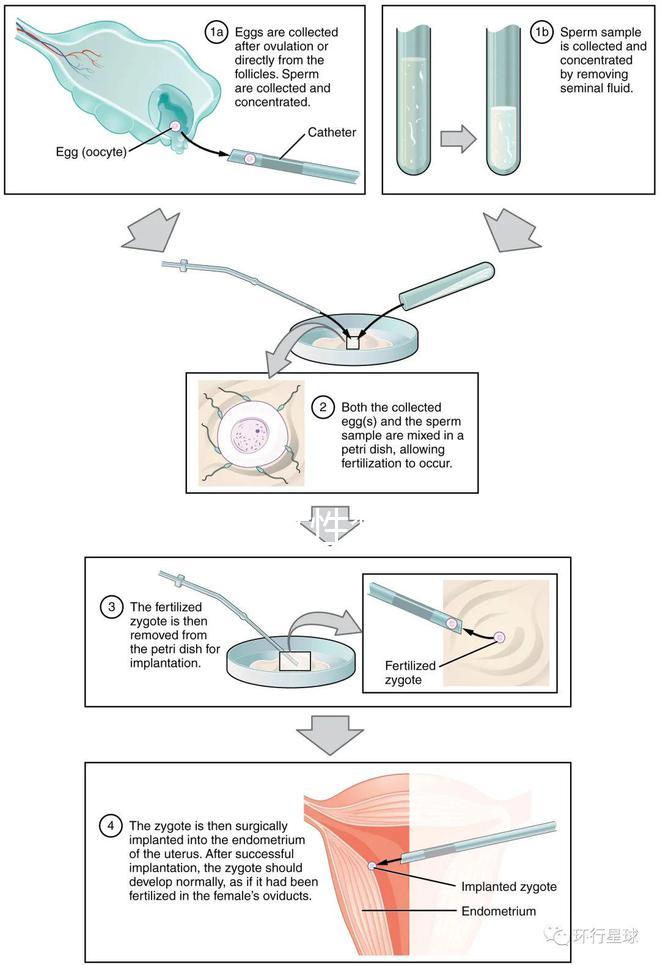 貴陽單身女性禁止凍卵？持“三證”已婚女性就能凍卵