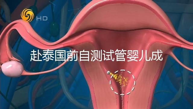 赴泰國(guó)前自測(cè)試管嬰兒成功率，這些方法值得收藏
