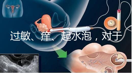 過敏、癢、起水泡，對于三伏貼的副作用你需知道該怎么辦