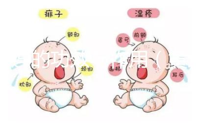 黃連的功效與作用（黃連片對(duì)男性性功能的效果）