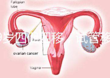 39歲四促四移，試管移植失敗5次后應該怎么辦？