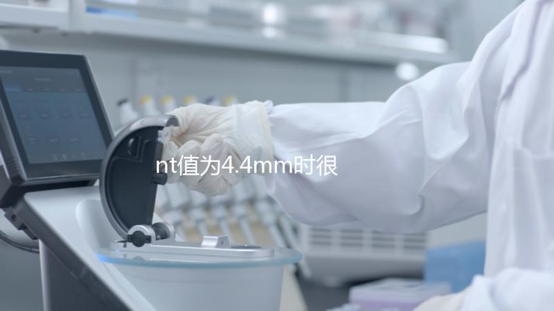 nt值為4.4mm時很危險，及時羊穿確認胎兒畸形很重要