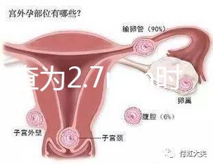 nt檢查為2.7mm時危險性莫亂猜，做完無創后才能確定